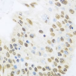ZBTB17 Polyclonal Antibody:Antibodies, Polyclonal