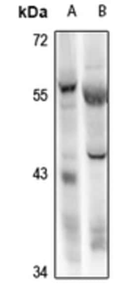 Invitrogen RBPJL Polyclonal Antibody 100 &mu;L | Buy Online | Invitrogen&trade; | Fisher Scientific