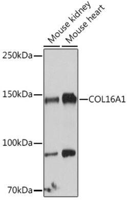 Invitrogen COL16A1 Polyclonal Antibody 100 &mu;L | Buy Online | Invitrogen&trade; | Fisher Scientific