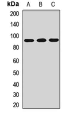 Invitrogen ACBD5 Polyclonal Antibody 100 &mu;L; Unconjugated:Antibodies,