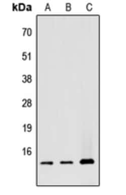 Invitrogen ATP5G1 Polyclonal Antibody 100 &mu;L; Unconjugated:Anticuerpos