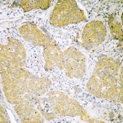 Invitrogen MCU Polyclonal Antibody 100 &mu;L; Unconjugated:Antibodies,