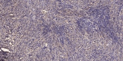 Invitrogen DYNC1H1 Polyclonal Antibody 100 &mu;L; Unconjugated:Antibodies,