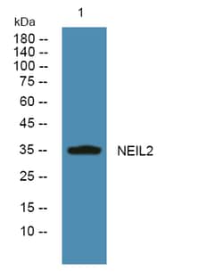 Invitrogen NEIL2 Polyclonal Antibody 100 &mu;L | Buy Online | Invitrogen&trade; | Fisher Scientific