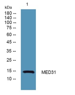 Invitrogen MED31 Polyclonal Antibody 100 &mu;L | Buy Online | Invitrogen&trade; | Fisher Scientific