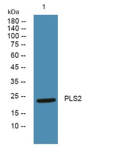 Invitrogen PLSCR2 Polyclonal Antibody 100 &mu;L | Buy Online | Invitrogen&trade; | Fisher Scientific