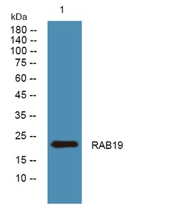 Invitrogen RAB19 Polyclonal Antibody 100 &mu;L | Buy Online | Invitrogen&trade; | Fisher Scientific