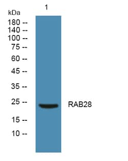 Invitrogen RAB28 Polyclonal Antibody 100 &mu;L | Buy Online | Invitrogen&trade; | Fisher Scientific