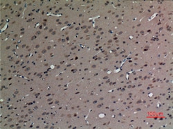 SV2C Polyclonal Antibody:Antibodies, Polyclonal