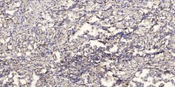 Invitrogen SYT10 Polyclonal Antibody 100 &mu;L; Unconjugated:Antibodies,
