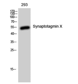 Invitrogen SYT10 Polyclonal Antibody 100 &mu;L; Unconjugated:Antibodies,