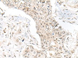 Invitrogen ASXL1 Polyclonal Antibody 100 &mu;L; Unconjugated:Antibodies,