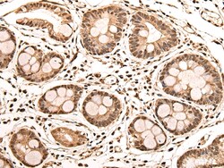 Invitrogen ASXL2 Polyclonal Antibody 100 &mu;L; Unconjugated:Antibodies,
