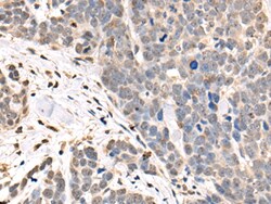 Invitrogen ASXL2 Polyclonal Antibody 100 &mu;L; Unconjugated:Antibodies,