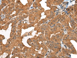 Invitrogen MIC-1 Polyclonal Antibody 100 &mu;L; Unconjugated:Antibodies,