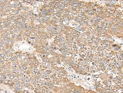 C1orf101 Polyclonal Antibody:Antibodies, Polyclonal