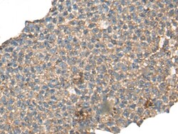Invitrogen CABP5 Polyclonal Antibody 100 &mu;L; Unconjugated:Antibodies,