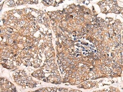 Invitrogen CACNA2D2 Polyclonal Antibody 100 &mu;L; Unconjugated:Antibodies,