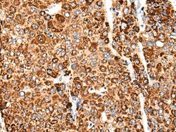 Invitrogen CACNG5 Polyclonal Antibody 100 &mu;L; Unconjugated:Antibodies,