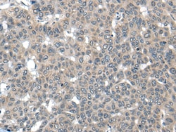 Invitrogen COP1 Polyclonal Antibody 100 &mu;L; Unconjugated:Antibodies,