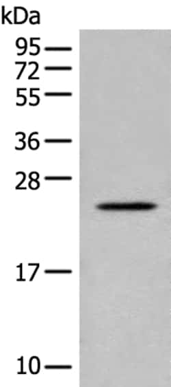 Invitrogen COP1 Polyclonal Antibody 100 &mu;L; Unconjugated:Antibodies,