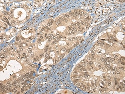 Invitrogen CC2D1A Polyclonal Antibody 100 &mu;L; Unconjugated:Antibodies,