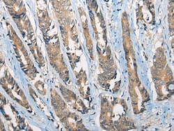 Invitrogen CCIN Polyclonal Antibody 100 &mu;L; Unconjugated:Antibodies,