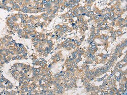 Invitrogen CCIN Polyclonal Antibody 100 &mu;L; Unconjugated:Antibodies,