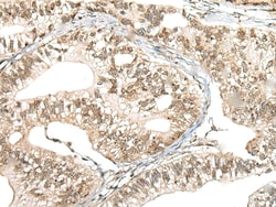 Invitrogen CCNK Polyclonal Antibody 100 &mu;L; Unconjugated:Anticuerpos