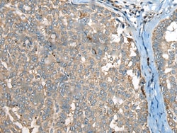 Invitrogen CCT6B Polyclonal Antibody 100 &mu;L; Unconjugated:Antibodies,