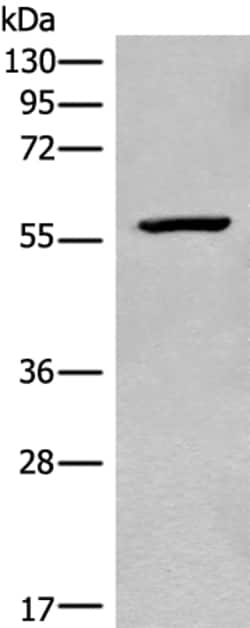 Invitrogen CDADC1 Polyclonal Antibody 100 &mu;L | Buy Online | Invitrogen&trade; | Fisher Scientific