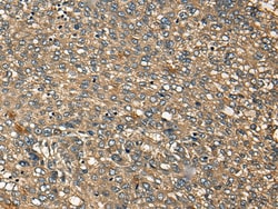 Invitrogen MRCK alpha Polyclonal Antibody 100 &mu;L; Unconjugated:Antibodies,