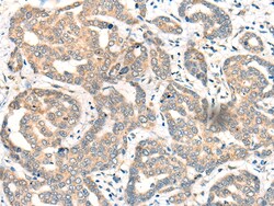 Invitrogen CDK2AP1 Polyclonal Antibody 100 &mu;L; Unconjugated:Antibodies,