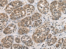 Invitrogen CECR6 Polyclonal Antibody 100 &mu;L; Unconjugated:Antibodies,