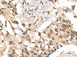 Invitrogen CECR6 Polyclonal Antibody 100 &mu;L; Unconjugated:Antibodies,