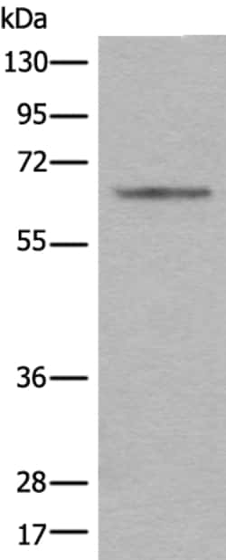 Invitrogen CENPT Polyclonal Antibody 100 &mu;L | Buy Online | Invitrogen&trade; | Fisher Scientific