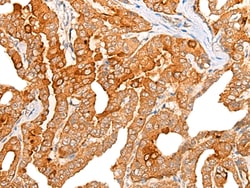 Invitrogen Chordin Polyclonal Antibody 100 μL; Unconjugated:Antibodies,