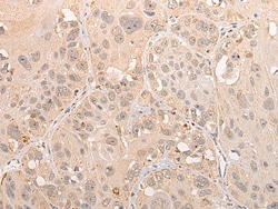 Invitrogen CINP Polyclonal Antibody 100 &mu;L; Unconjugated:Antibodies,