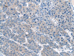 Invitrogen CITED4 Polyclonal Antibody 100 &mu;L; Unconjugated:Antibodies,