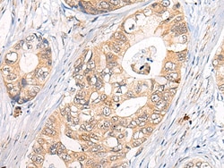 Invitrogen CLPTM1 Polyclonal Antibody 100 &mu;L; Unconjugated:Antibodies,