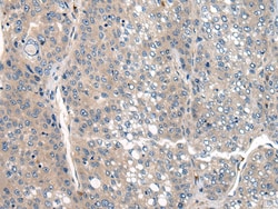 Invitrogen CLTCL1 Polyclonal Antibody 100 &mu;L; Unconjugated:Antibodies,