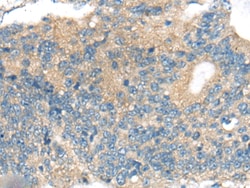 Invitrogen CNTNAP1 Polyclonal Antibody 100 &mu;L; Unconjugated:Antibodies,