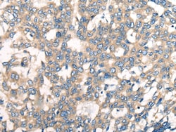Invitrogen CNTNAP1 Polyclonal Antibody 100 &mu;L; Unconjugated:Antibodies,