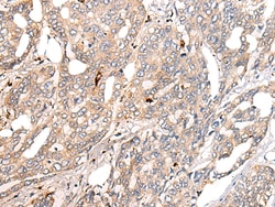 Invitrogen COL11A1 Polyclonal Antibody 100 &mu;L; Unconjugated:Antibodies,