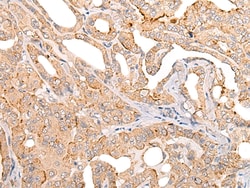 Invitrogen COL11A1 Polyclonal Antibody 100 &mu;L; Unconjugated:Antibodies,