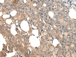 Invitrogen COX7A2L Polyclonal Antibody 100 &mu;L | Buy Online | Invitrogen&trade; | Fisher Scientific