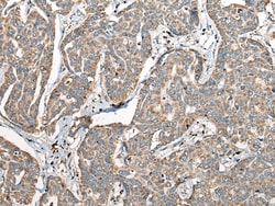 Invitrogen COX7A2L Polyclonal Antibody 100 &mu;L | Buy Online | Invitrogen&trade; | Fisher Scientific