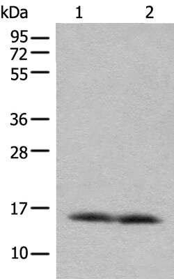 Invitrogen COX7A2L Polyclonal Antibody 100 &mu;L | Buy Online | Invitrogen&trade; | Fisher Scientific