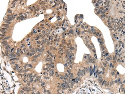 Invitrogen DNASE1L2 Polyclonal Antibody 100 &mu;L; Unconjugated:Antibodies,