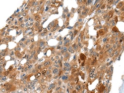 Invitrogen DNASE1L2 Polyclonal Antibody 100 &mu;L; Unconjugated:Antibodies,